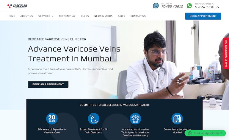 Dr jathin varicose vein center